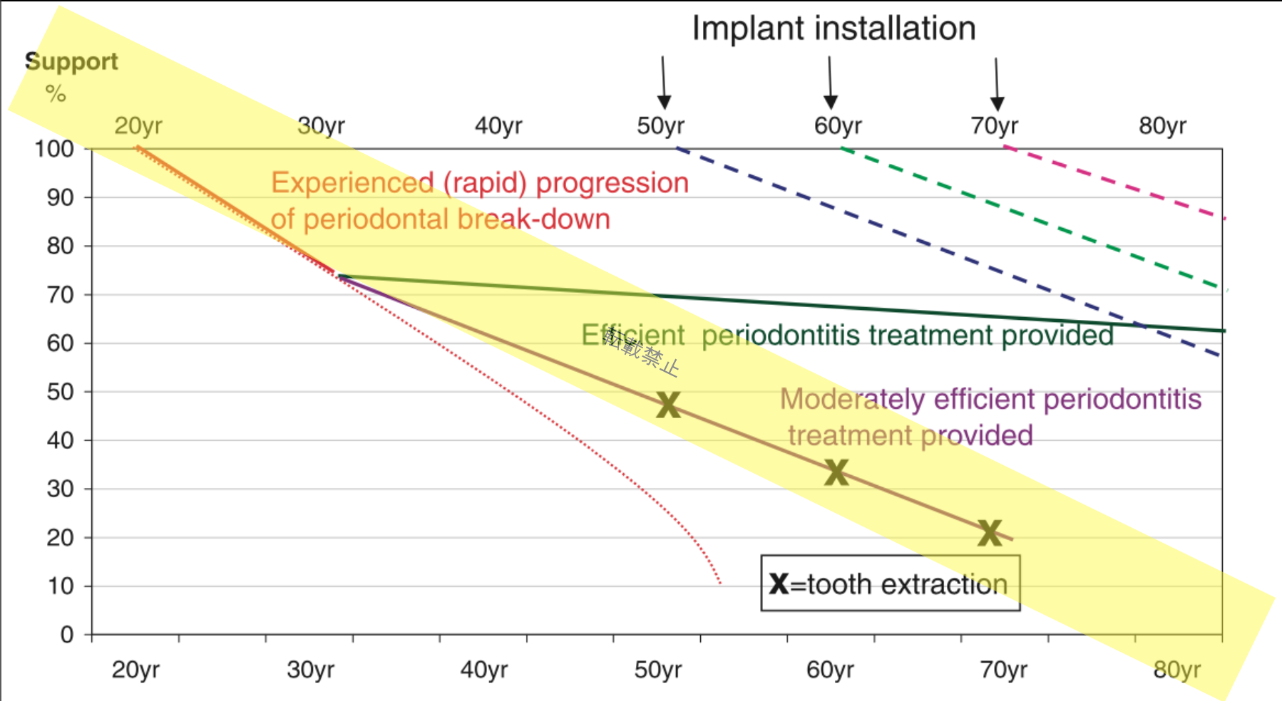 implant-installation-2